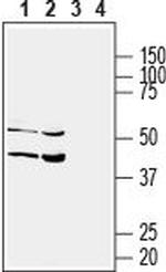 SLC17A5 (Sialin) Antibody in Western Blot (WB)