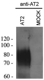 AGTR2 Antibody in Western Blot (WB)