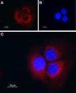 TRIC-B (TMEM38B) Antibody in Immunocytochemistry (ICC/IF)