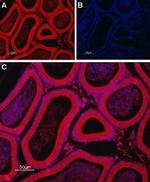 TRIC-B (TMEM38B) Antibody in Immunohistochemistry (Paraffin) (IHC (P))