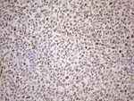 ATF1 Antibody in Immunohistochemistry (Paraffin) (IHC (P))