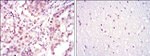 ATF2 Antibody in Immunohistochemistry (Paraffin) (IHC (P))