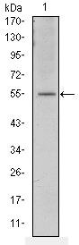 ATF2 Antibody in Western Blot (WB)