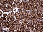 ATG16L1 Antibody in Immunohistochemistry (Paraffin) (IHC (P))