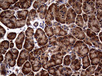 ATG16L1 Antibody in Immunohistochemistry (Paraffin) (IHC (P))