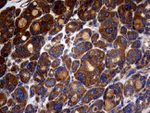 ATG16L1 Antibody in Immunohistochemistry (Paraffin) (IHC (P))