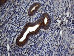 ATG16L1 Antibody in Immunohistochemistry (Paraffin) (IHC (P))