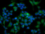 ATG3 Antibody in Immunocytochemistry (ICC/IF)