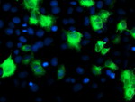 ATG3 Antibody in Immunocytochemistry (ICC/IF)