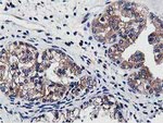 ATG3 Antibody in Immunohistochemistry (Paraffin) (IHC (P))