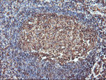 ATG3 Antibody in Immunohistochemistry (Paraffin) (IHC (P))