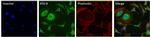 ATG9A Antibody in Immunocytochemistry (ICC/IF)