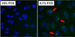 ATG9A Antibody in Immunocytochemistry (ICC/IF)