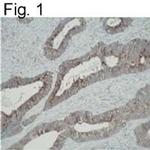 ATIC Antibody in Immunohistochemistry (IHC)