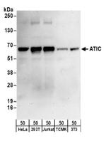 ATIC Antibody in Western Blot (WB)