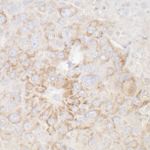 ATP5A1 Antibody in Immunohistochemistry (IHC)