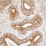 ATP5A1 Antibody in Immunohistochemistry (IHC)