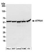 ATP5A1 Antibody in Western Blot (WB)