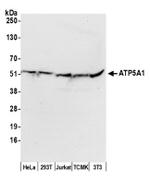 ATP5A1 Antibody in Western Blot (WB)