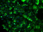 ATP5B Antibody in Immunocytochemistry (ICC/IF)