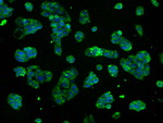 ATP5B Antibody in Immunocytochemistry (ICC/IF)