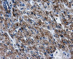 ATP5B Antibody in Immunohistochemistry (Paraffin) (IHC (P))