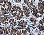 ATP5B Antibody in Immunohistochemistry (Paraffin) (IHC (P))