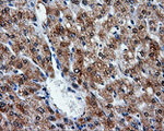 ATP5B Antibody in Immunohistochemistry (Paraffin) (IHC (P))