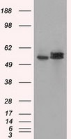 ATP5B Antibody in Western Blot (WB)