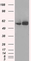 ATP5B Antibody in Western Blot (WB)