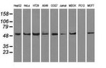 ATP5B Antibody in Western Blot (WB)