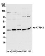 ATP5C1/ATPG Antibody in Western Blot (WB)