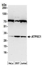 ATP5C1/ATPG Antibody in Western Blot (WB)