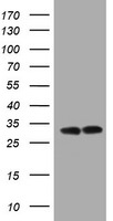 ATP5C1 Antibody in Western Blot (WB)