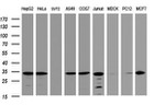 ATP5C1 Antibody in Western Blot (WB)