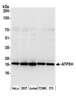 ATP5H Antibody in Western Blot (WB)