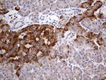 ATP6V0D2 Antibody in Immunohistochemistry (Paraffin) (IHC (P))