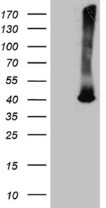 ATP6V0D2 Antibody in Western Blot (WB)