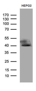 ATP6V0D2 Antibody in Western Blot (WB)