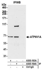 ATP6V1A Antibody in Western Blot (WB)