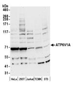 ATP6V1A Antibody in Western Blot (WB)