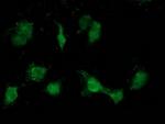 ATP6V1B1 Antibody in Immunocytochemistry (ICC/IF)