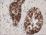 ATP6V1B1 Antibody in Immunohistochemistry (Paraffin) (IHC (P))