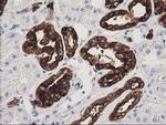 ATP6V1B1 Antibody in Immunohistochemistry (Paraffin) (IHC (P))