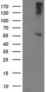 ATP6V1B1 Antibody in Western Blot (WB)