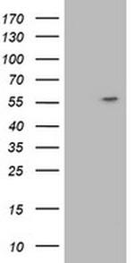 ATP6V1B1 Antibody in Western Blot (WB)