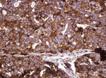 ATP6V1B2 Antibody in Immunohistochemistry (Paraffin) (IHC (P))