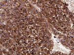 ATP6V1B2 Antibody in Immunohistochemistry (Paraffin) (IHC (P))