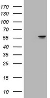 ATP6V1B2 Antibody in Western Blot (WB)