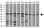 ATP6V1B2 Antibody in Western Blot (WB)